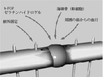 図4